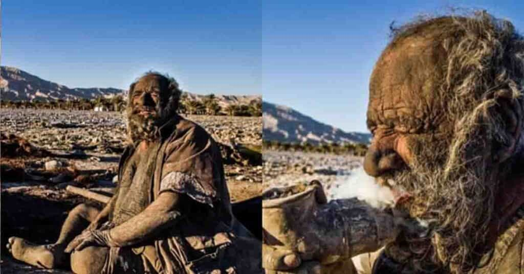 Worlds Dirtiest Man – दुनिया का सबसे गंदा आदमी, 67 सालों से नहीं नहाया, जाने वजह