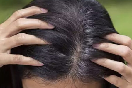 White Hair Problem with Home Remedies: काले बाल वापिस पाने के लिए करें घरेलु उपचार