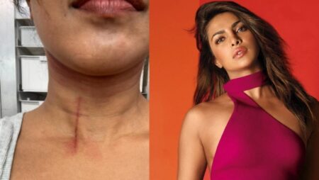 Priyanka Chopra Injured : फिल्म शूटिंग दौरान प्रियंका चोपड़ा को गर्दन पर लगी चोट, एक्ट्रेस ने शेयर तस्वीर