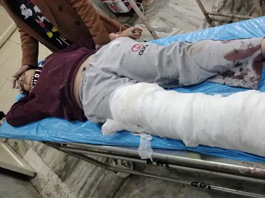 Punjab News : पंजाब रोडवेज के कंडक्टर ने बच्चे को बस से बाहर फेंका, चिल्लाती रही दादी 1 acc 2 acc 2 Punjab News