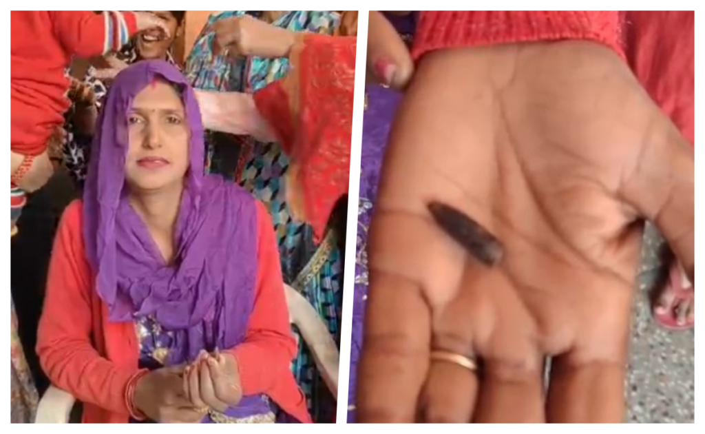 Bullet In Woman Body : चौंकाने वाली कहानी: 20 साल तक महिला के शरीर में दबी रही SLR राइफल की गोली, फोड़ा फटते ही निकली बाहर Bullet In Woman Body : चौंकाने वाली कहानी: 20 साल तक महिला के शरीर में दबी रही SLR राइफल की गोली, फोड़ा फटते ही निकली बाहर